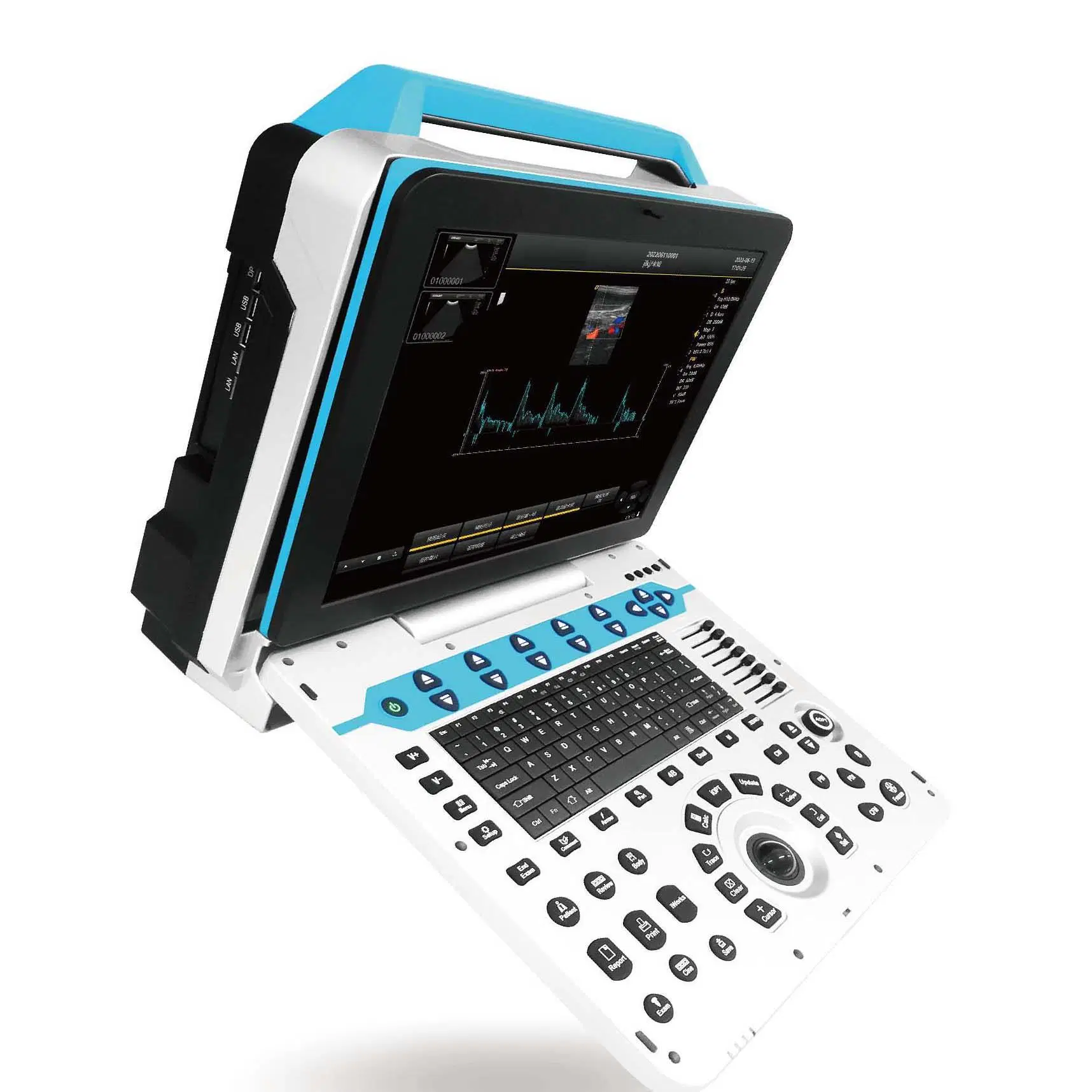 Échographe portable échographie vétérinaire Doppler couleur taille 15 Moniteur d'pouces