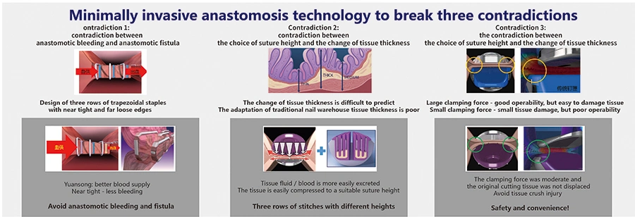 Medizinische Betriebsmittel Cutter Chirurgischer Hefter für minimal invasive Sugery (Endoskop)