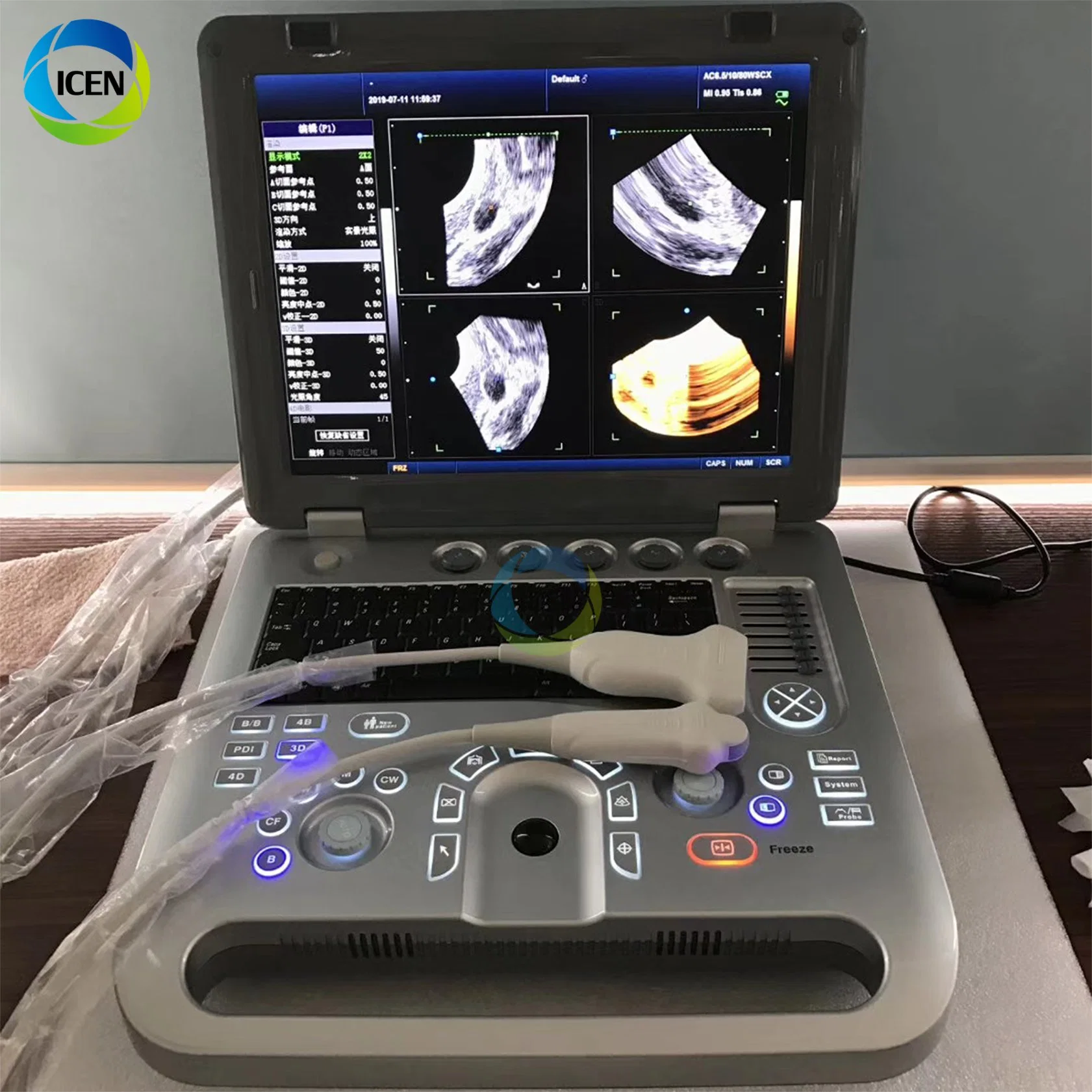 IN-AN50C ICEN laptop color doppler machine portable ultrasound machine