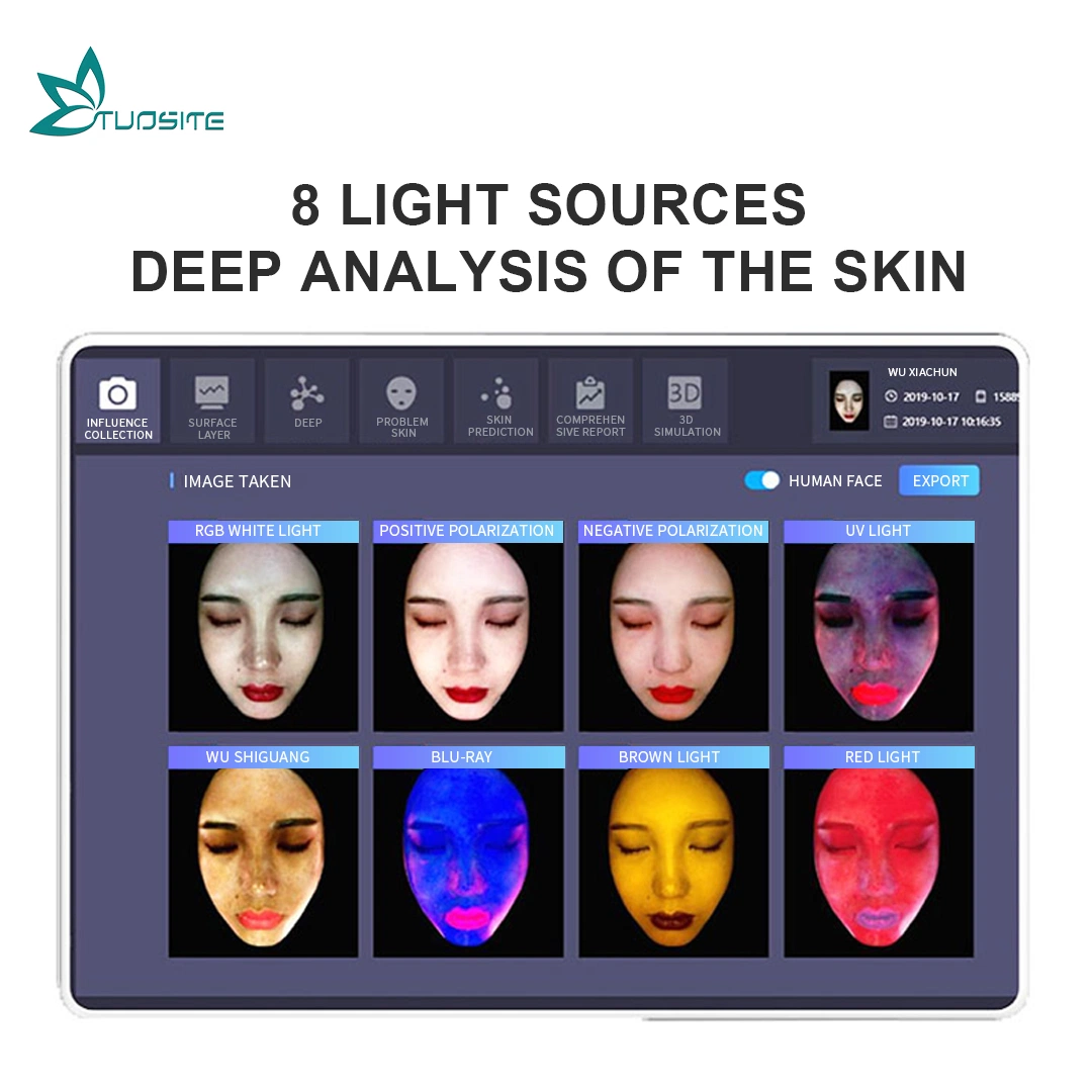 Skin Analysis Machine Skin Condition Analyzer Max Version Fast Identification of Skin Problem Report Support