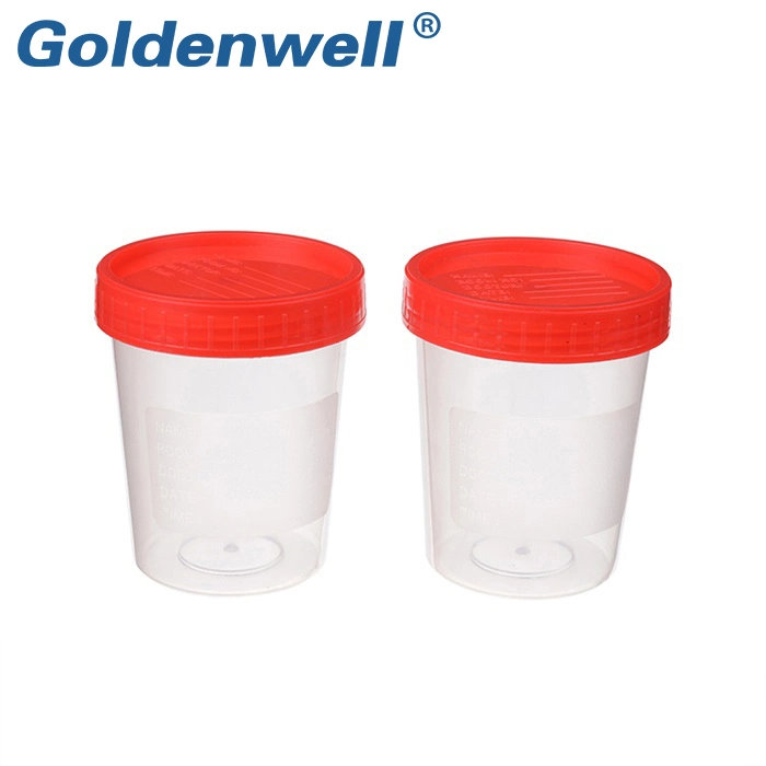 Disposable Medical Vacuum Urine Collection Tube with Urine Test Container