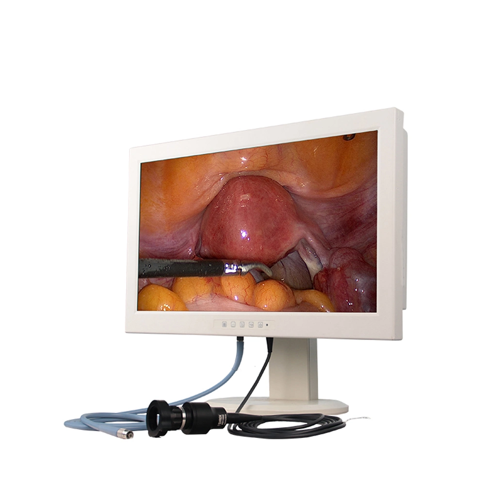 Grade Shutterstock Ba Medical Cyborg Endoscopie Endoscope moniteur écran HD