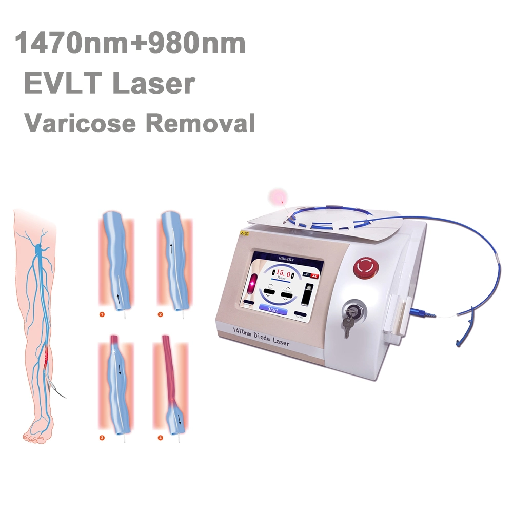 جهاز Veins محمول بتقنية الليزر بتقنية Evlt، بتقنية Varicose 1470nm