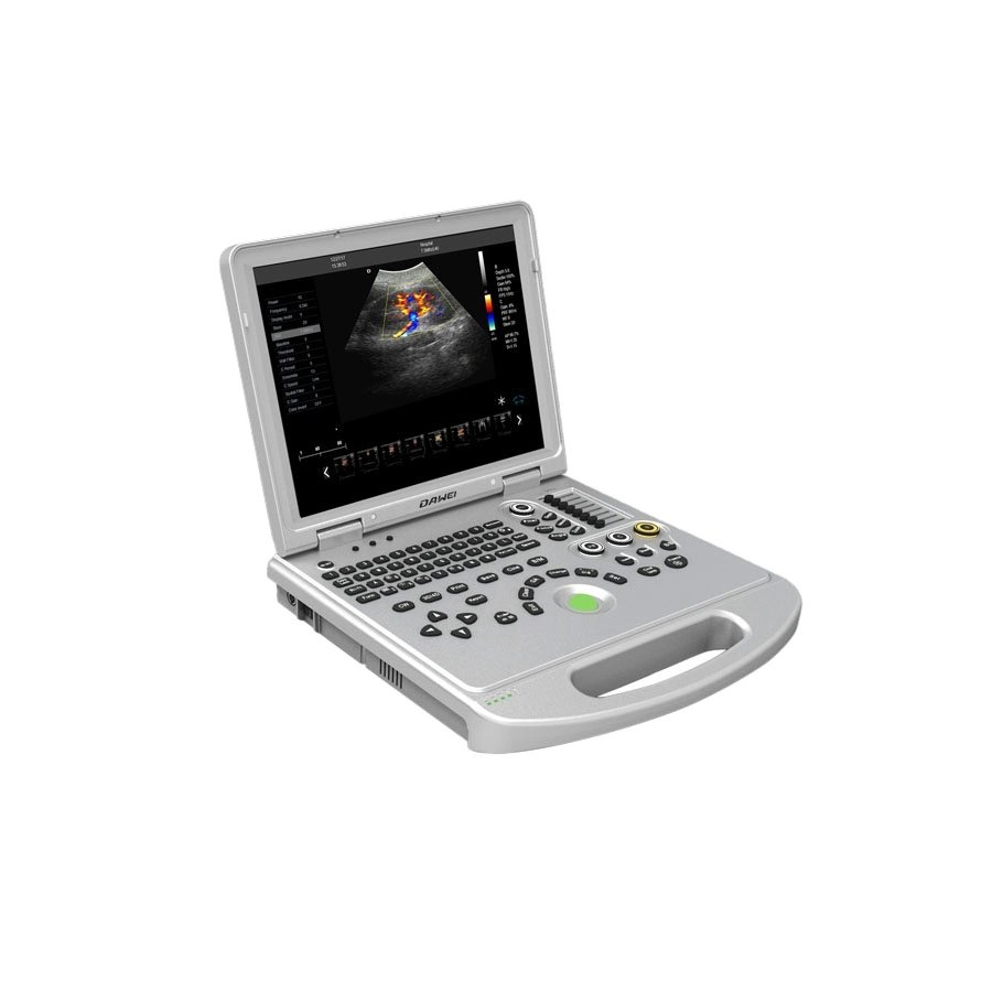 Portable Vet Versatility Full Digital Laptop Portable Ultrasound Scanner Machine with CE ISO