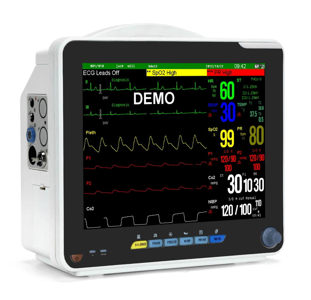 Sinnor Snp9000n paciente Moniter con ECG+SpO2+ETCO2+Resp+PNI+la presión arterial +directamente de fábrica