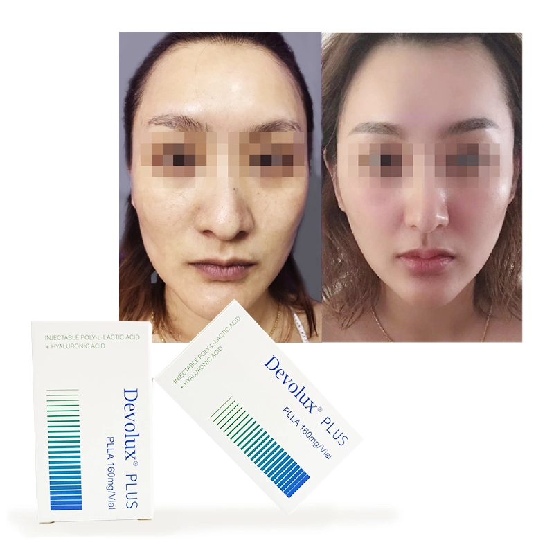 Devolux Plus Buy Powder Filler Poly Lactic Acid Plla for Face Injection