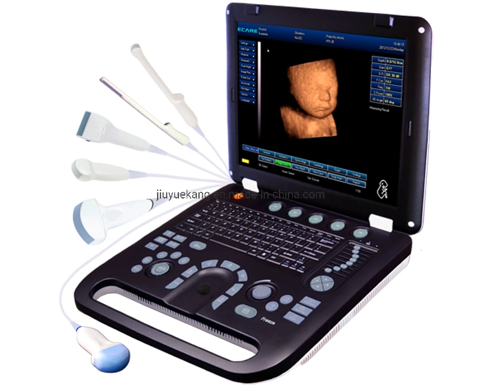 Medical Equipment, Portable 16 Channel Digital Ultrasound Scanner