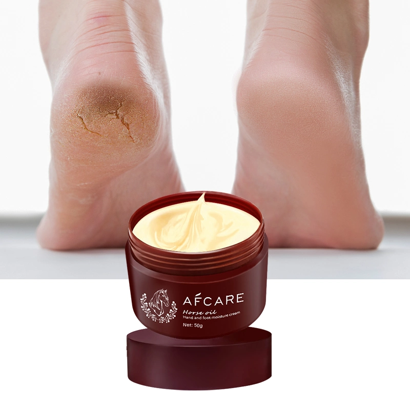 Dead Skin Removal Moisturizes Soften for Dry Cracked Heels Foot Cream