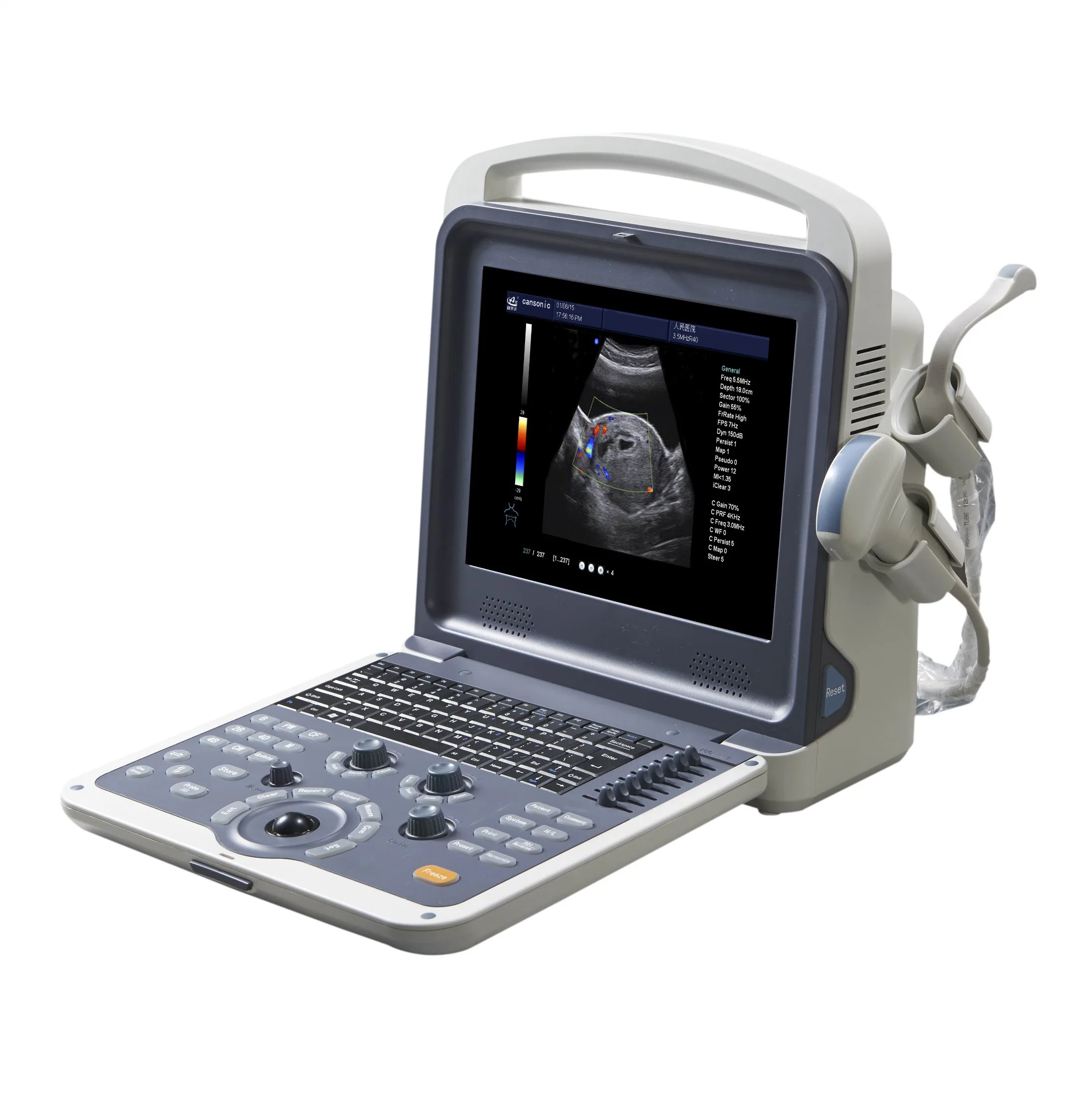 Portable Ultrasound Guidance System (KMD3000P-1)