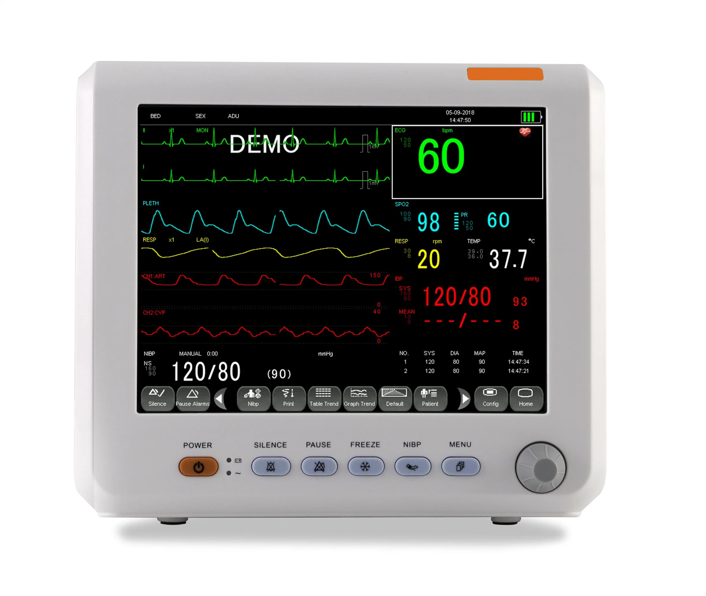 ISO Hospital ICU Cheap Portable Multi-Parameter Patient Monitor Em-6