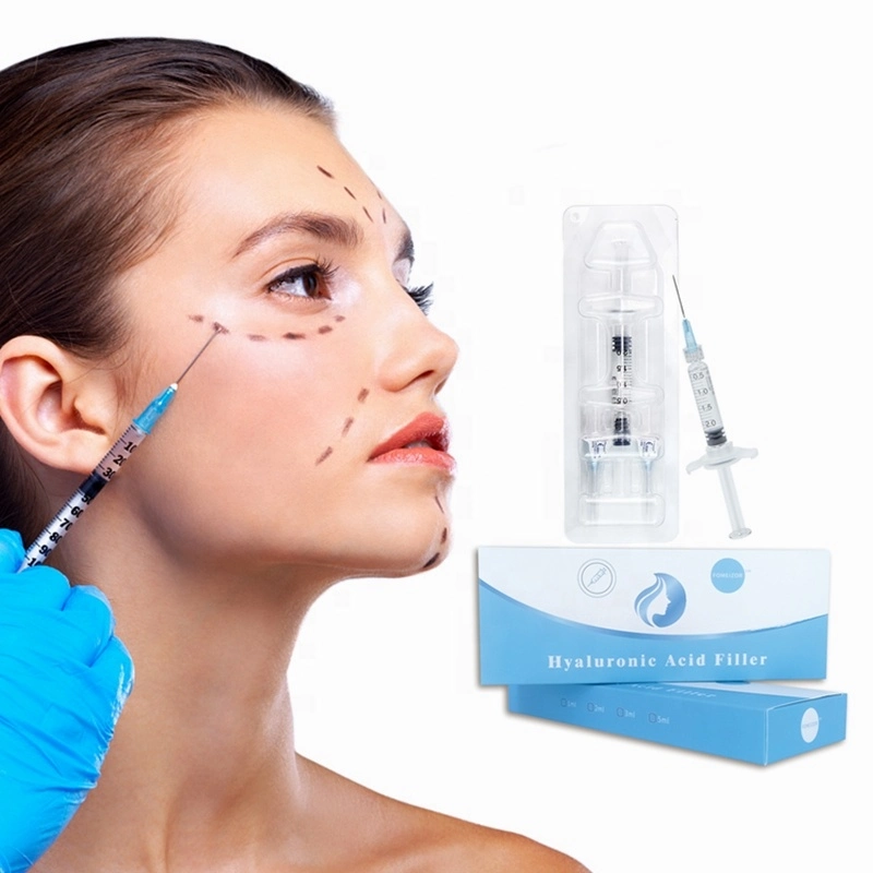 Injectable 2ml Dermal Filler Anti-Wrinkle Injection Hyaluronic Acid Face Filler