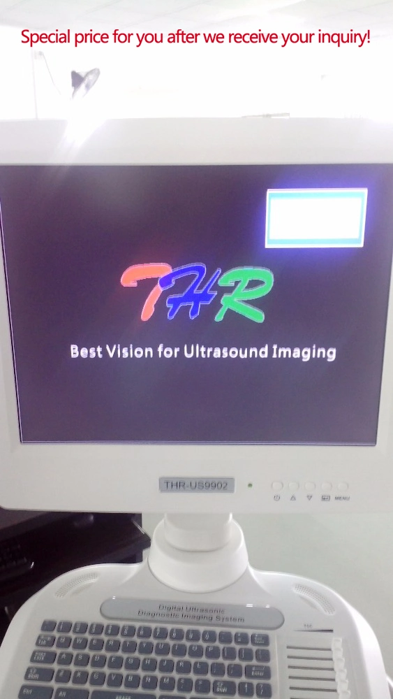 High Grade Ultrasound Diagnosing Device (THR-US9902)