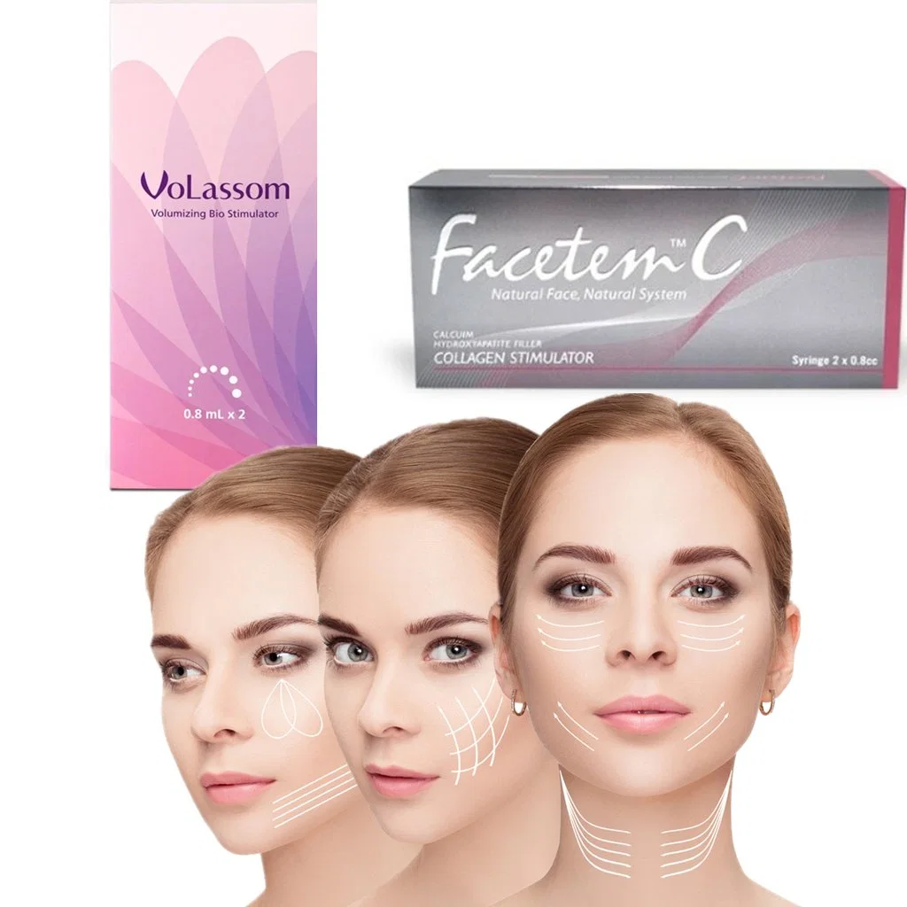 2023 Korea Filler Facetem Volassom 0.8ml*2 Calcium Hydroxylapatite Filler Natural Fillers with No Side Effects Facetem Calcium Radiesse Injection