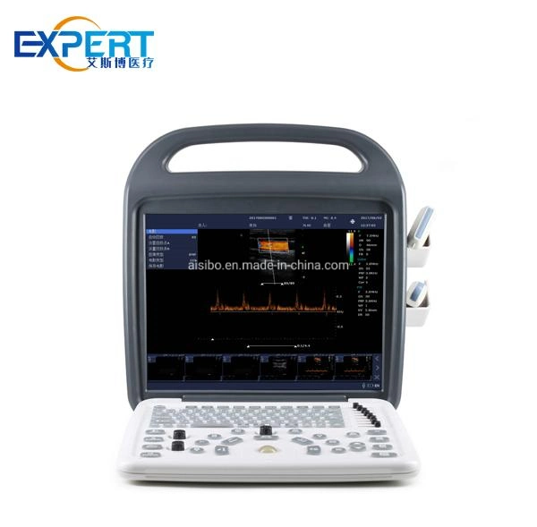 Doppler Vet Ultrasound Scanner High Technology Portable Function Color Vet Scanner