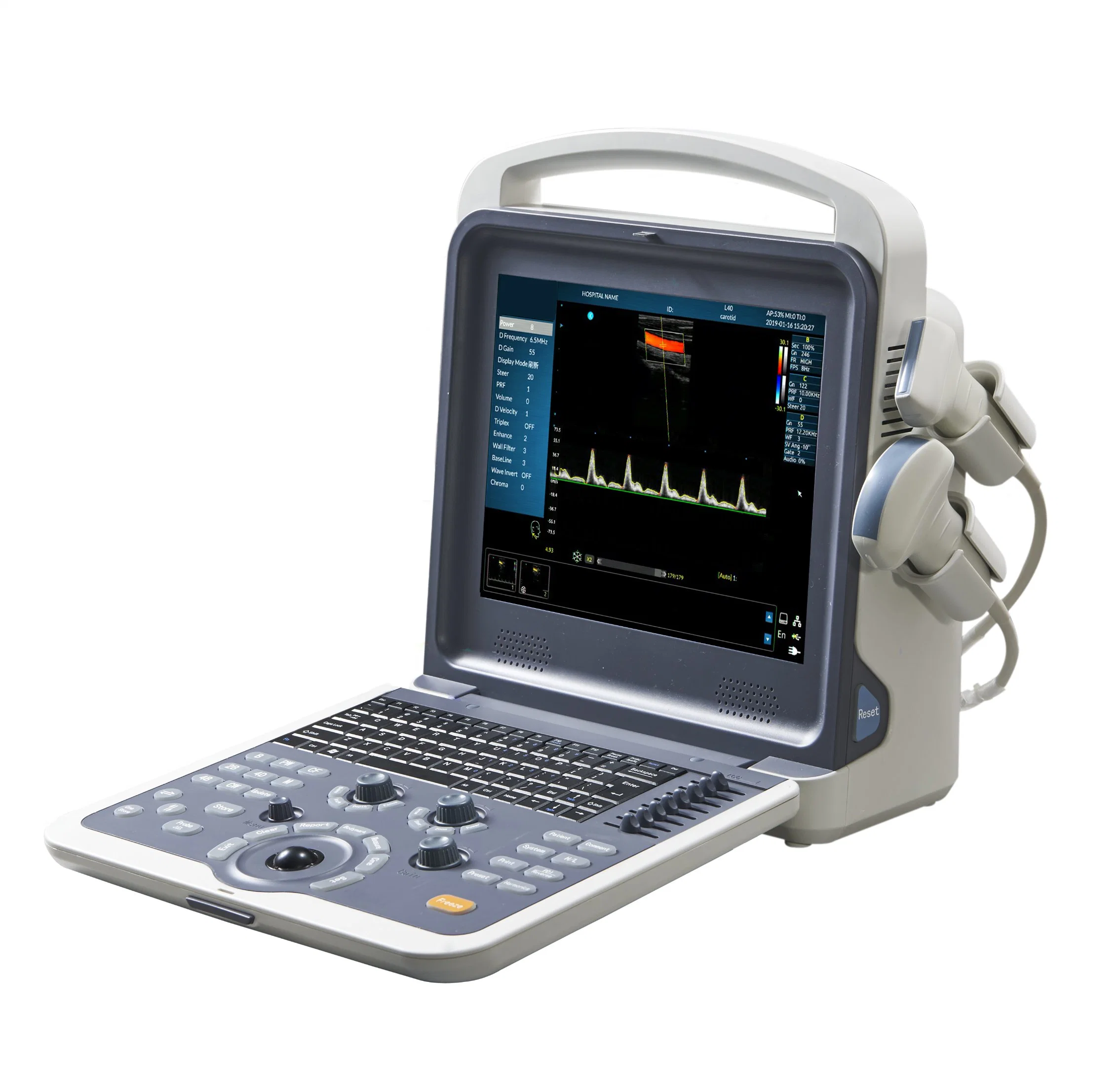 Portable Color Doppler Ultrasound Scanner 128 Elements