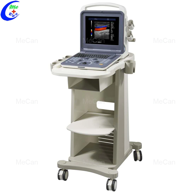 Portable Ecografo 4D Color Doppler Ultrasound Machine, Portable Echo Ultrasound Scanner