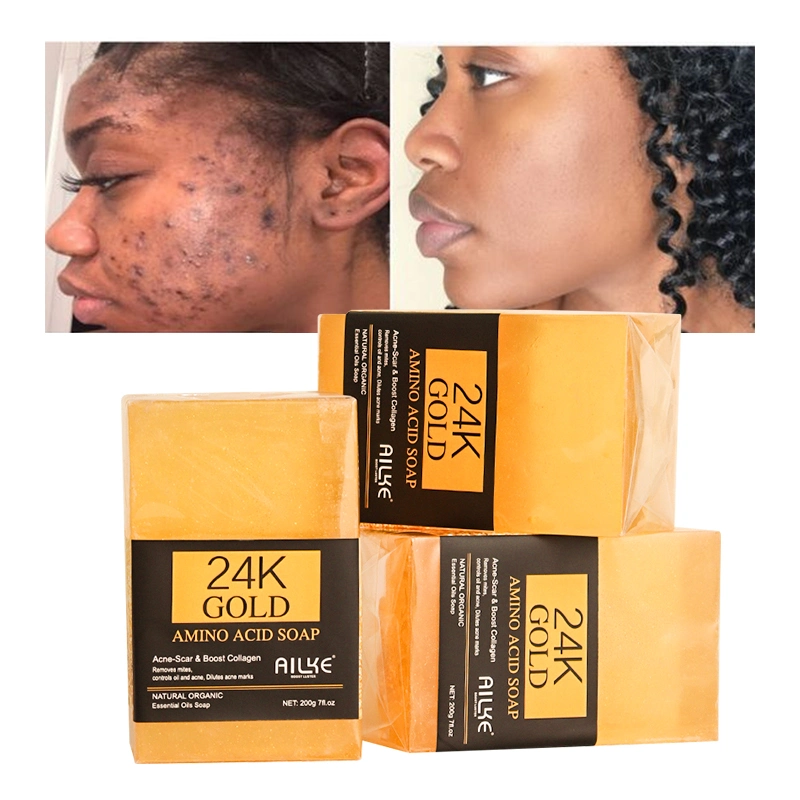 200g/PCS Anti Pimple Bar 24K Oro al por mayor Hotel Baño de Acne Jabón para eliminar granos