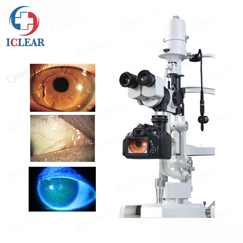 Classic Galilean Type Ophthalmic Digital Slit Lamp Microscope