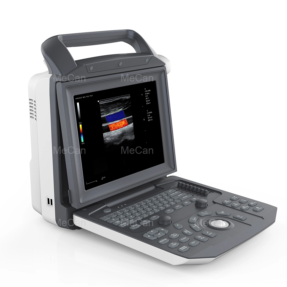 Doppler Bedside Ultrasound Machine Linear Portable Medical Ultrasound Scanner Instruments