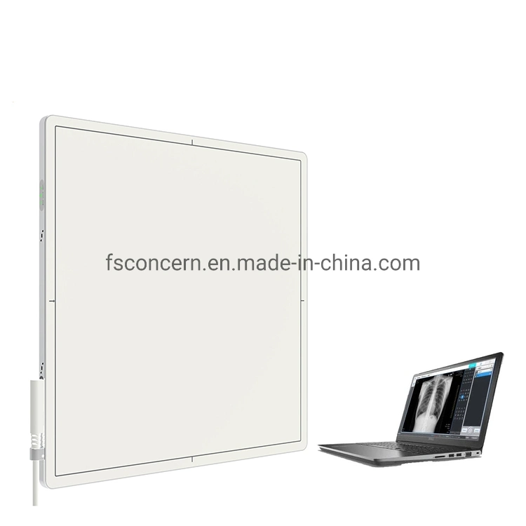 Pet Clinic Factory Price X Ray Dr Fpd Wireless Csi Veterinary Digital X-ray Flat Panel Detector