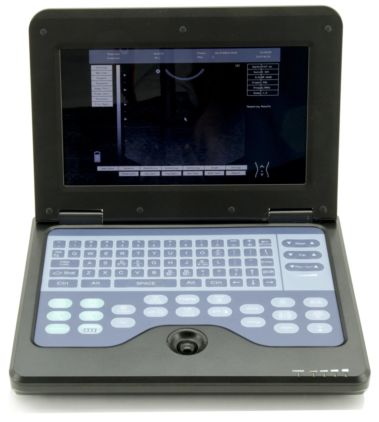 Cms600p2 Hopital Medical Equipment Notebook Diagnostic Ultrasound System Medical Equipment