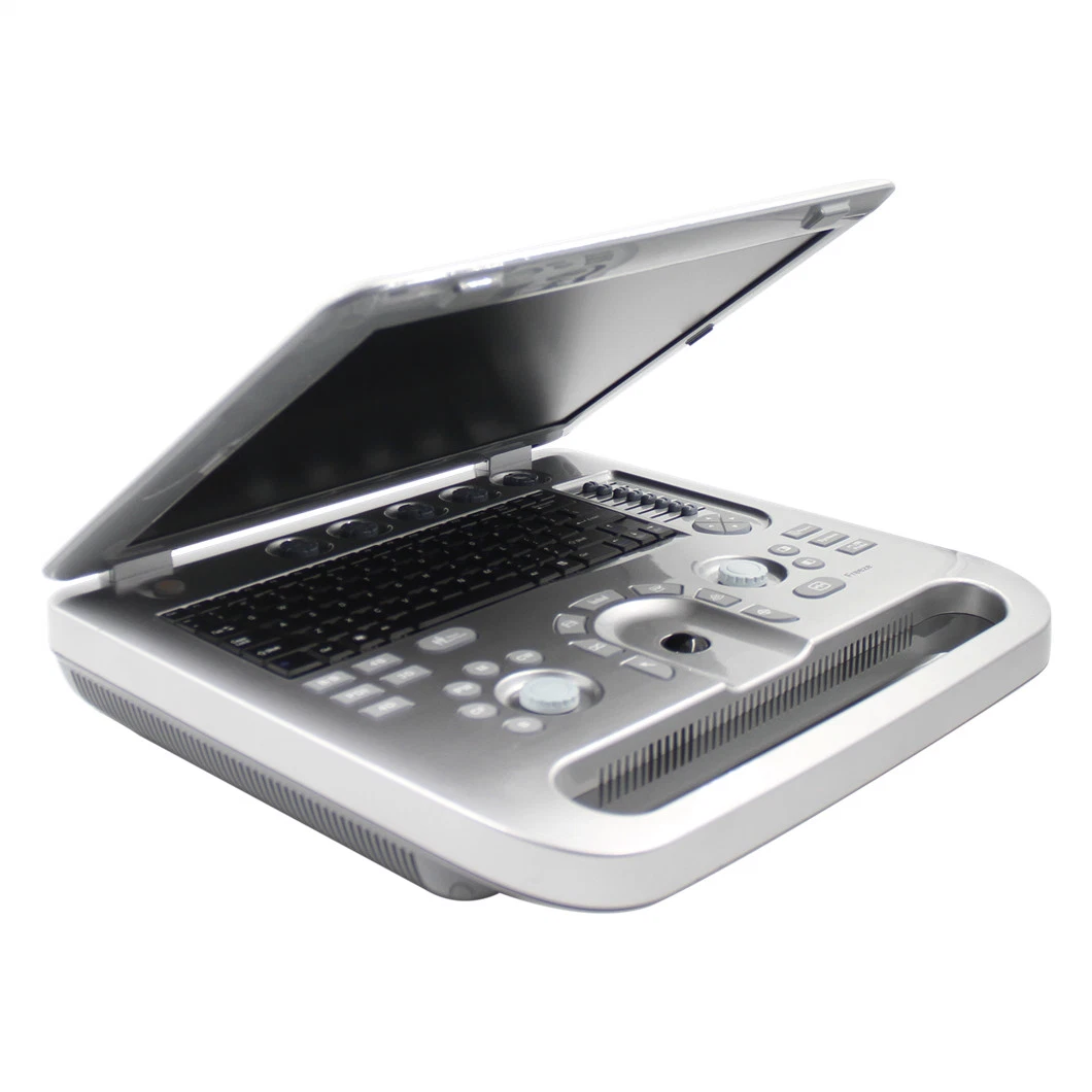 High quality/High cost performance Laptop Portable Color Doppler Ultrasound Scanner