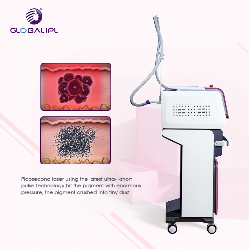 Medical High Power Q Switch ND: Q Switched ND YAG Laser