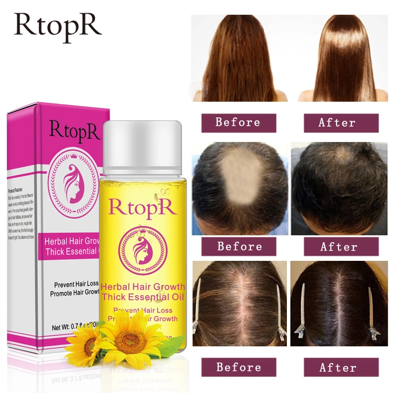 Rtopr Hair Care Natural Organic Hair Loss Treatment Herbal Wild Hair Growth Essential Oil for Women Men