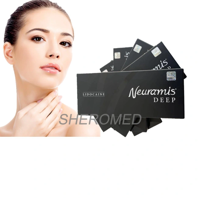 1.1 Ml Neuramis Hyaluronic Acid Filller for Facial