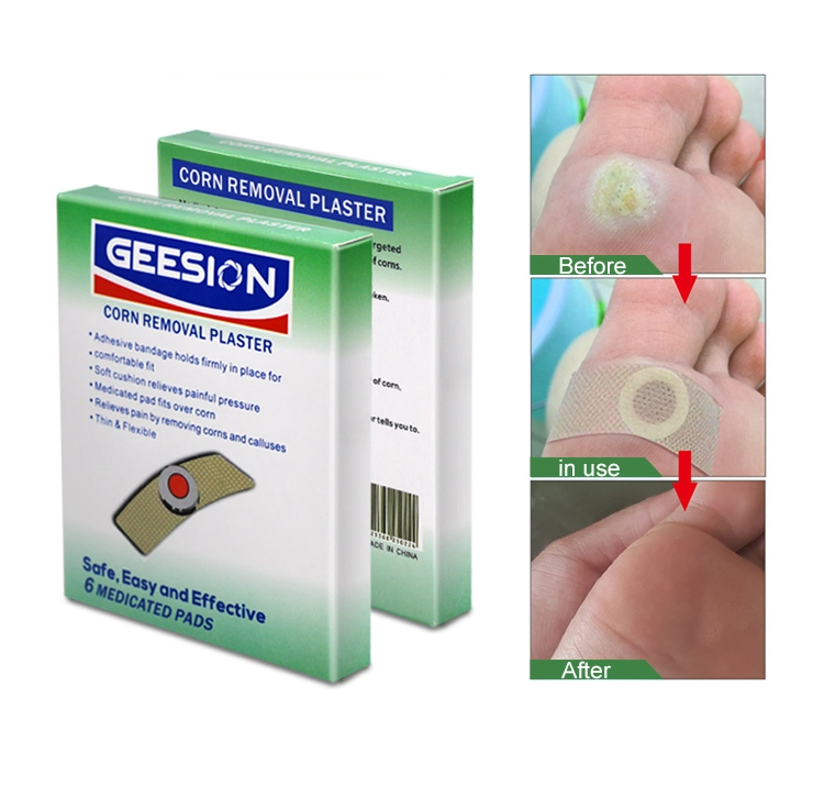 Medical Pain Relief Sticker Foot Corn Removal Patch