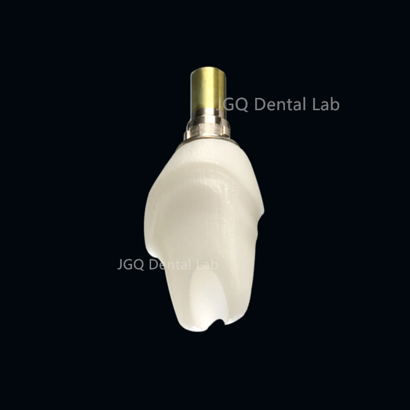 CE FDA Dental Multi Unit Abutment for Dental Implant