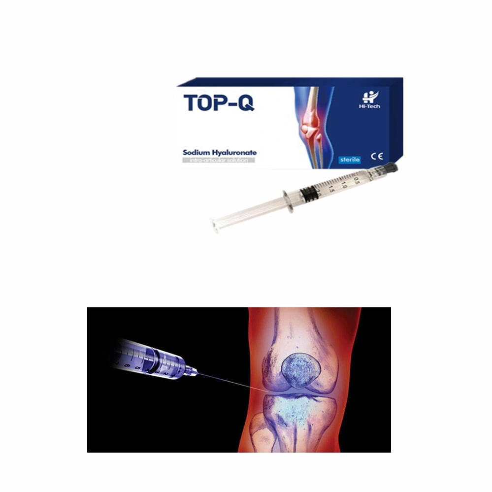 1ml High Safety Sodium Hyaluronate Gel Knee Joint Injection for Orthopedics