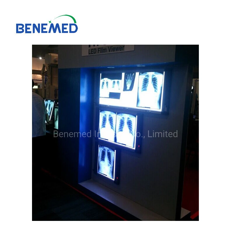 Hospital Use LED X-ray Film Viewer Four Section