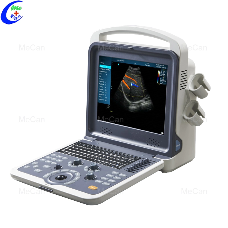 Hot Sale Full-Digital Portable B/W Ultrasound Scanner with Low Price