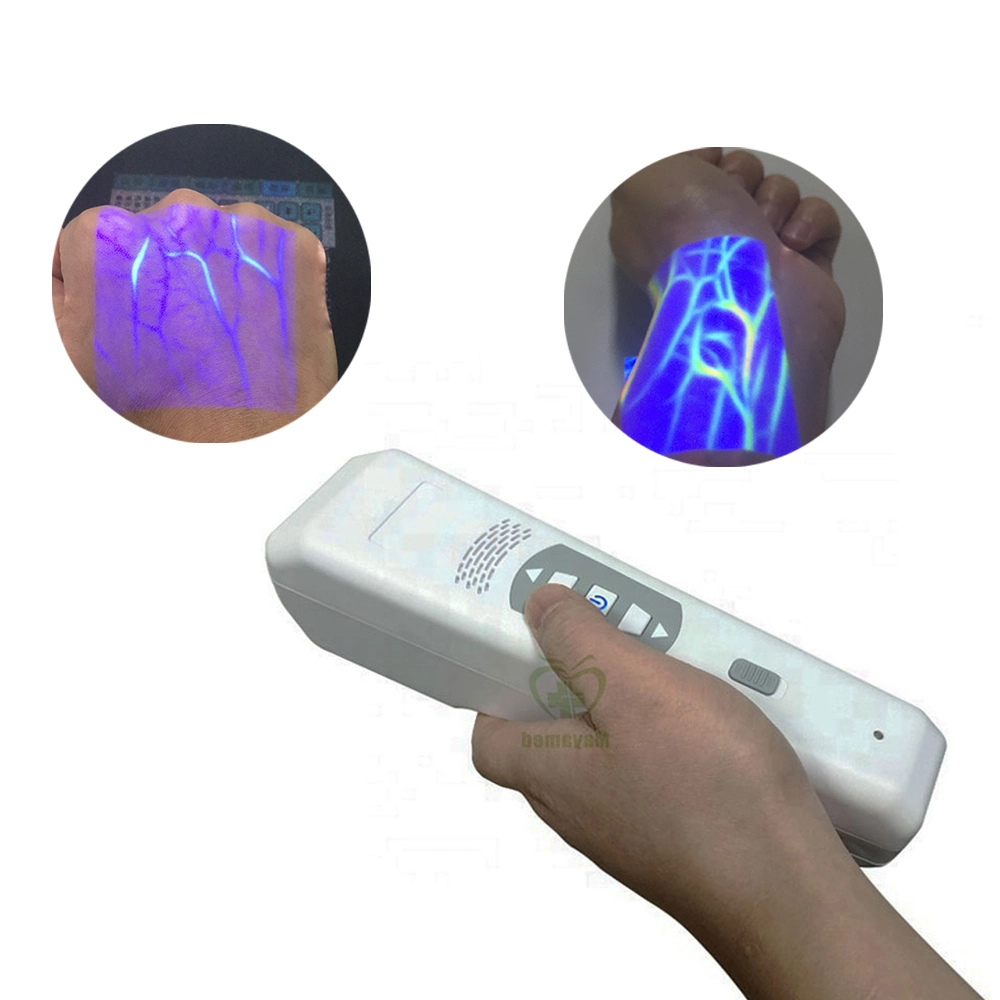 Medical Portable Vein Infrared Detector Venenfinder Recherche De Veine Veins Founder