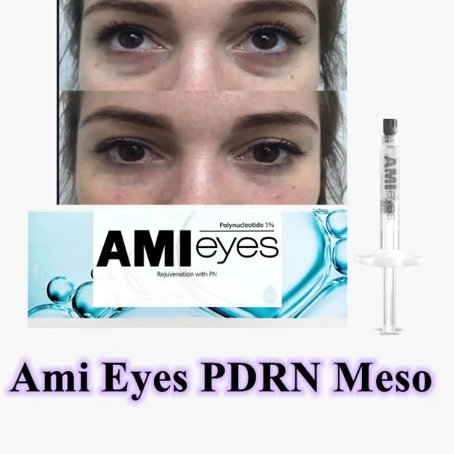 Venta caliente Ami ojos 2ml Pn Mesoterapia rejuvenecimiento de piel más joven de 10 años de bricolaje que blanquea el rejuvenecimiento de la piel Anti-Wrinkle Lumi ojos