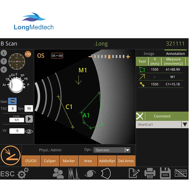 Ophthalmic Equipment Eye Ultrasound Ophthalmic Ultrasound Ab Scan for Eye Test