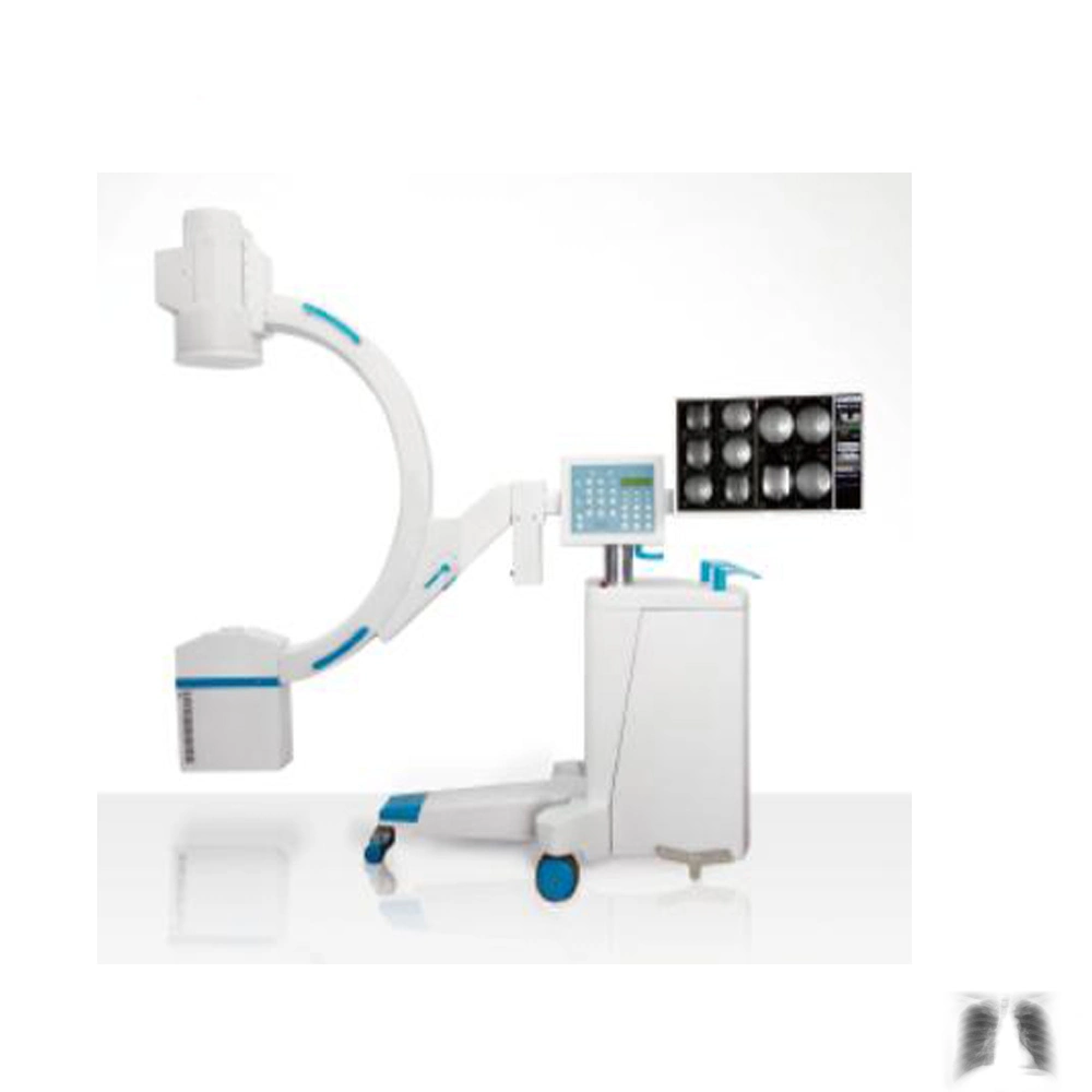 Raios X com braço em C médico do produto hospitalar com imagiologia digital para utilização