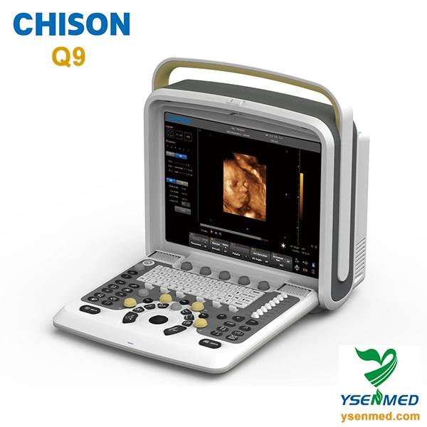 Chison Q9 Medical Portable Cardiac Color Ultrasound Scanner