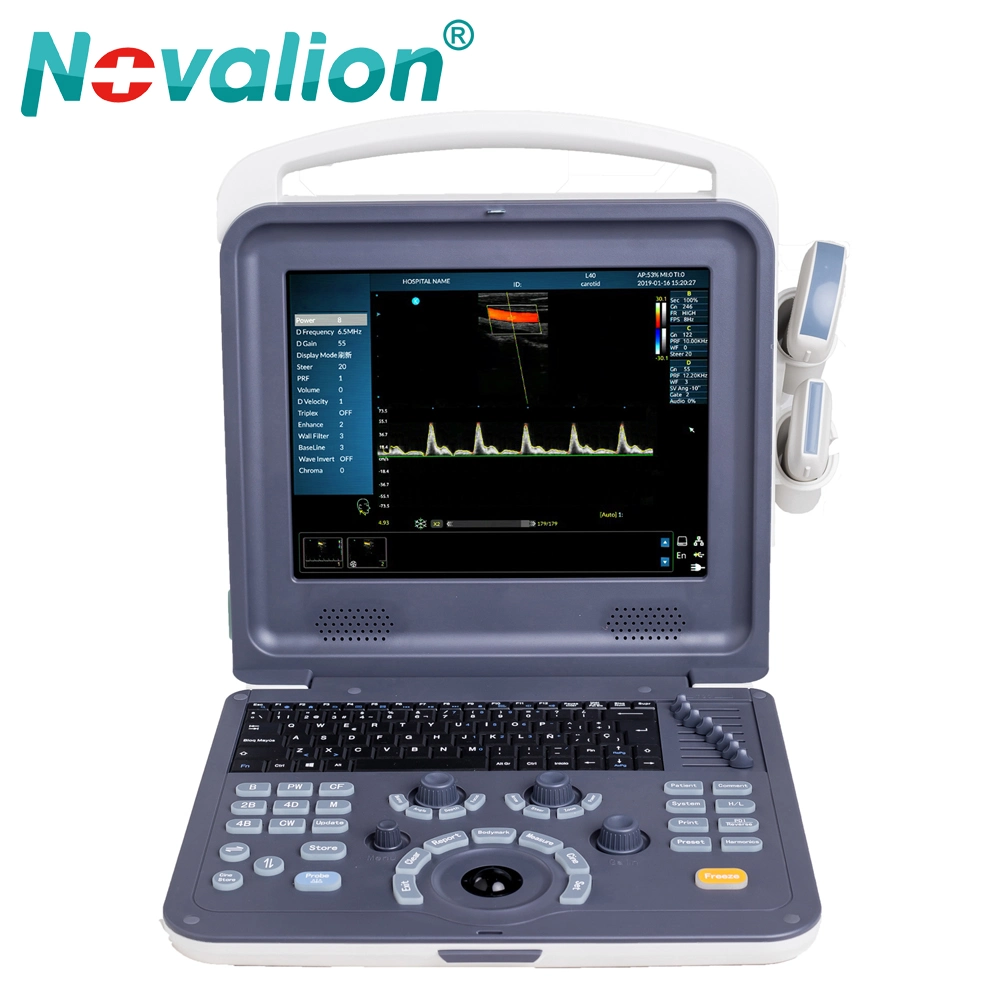 Fábrica Precio mayorista completo Digital portátil Doppler Color Diagnóstico por ultrasonido Sistema