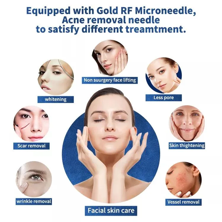 Garantie de 2 ans, serrage de la peau de la micro-aiguille fractionnelle RF la plus récente / RF fractionnelle microneedle radio fréquence cicatrice révision RF facial Appareil de beauté