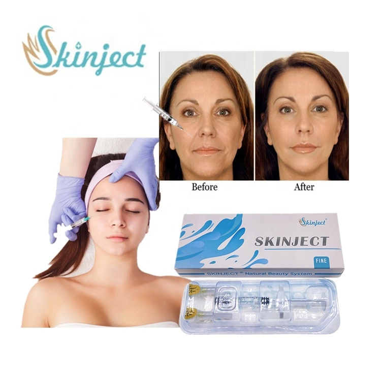 Salon Used 2ml Hyaluronate Acid Filler Professional Face Dermal Filler