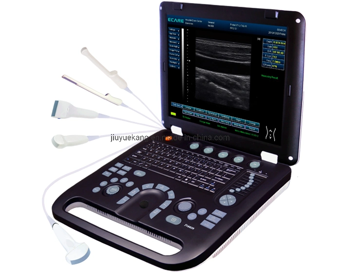 Medical Equipment, Portable Digital Color Doppler Ultrasound Scanner