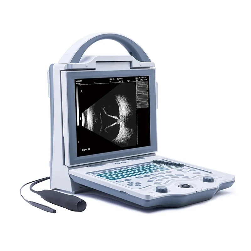 Medical 10.4 Inch LCD Screenophthalmic Portable Ultrasound Scanner Machine