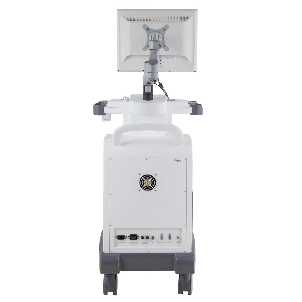 Trolley Type PC Based Vaginal B/W Mode Ultrasound Diagnostic System