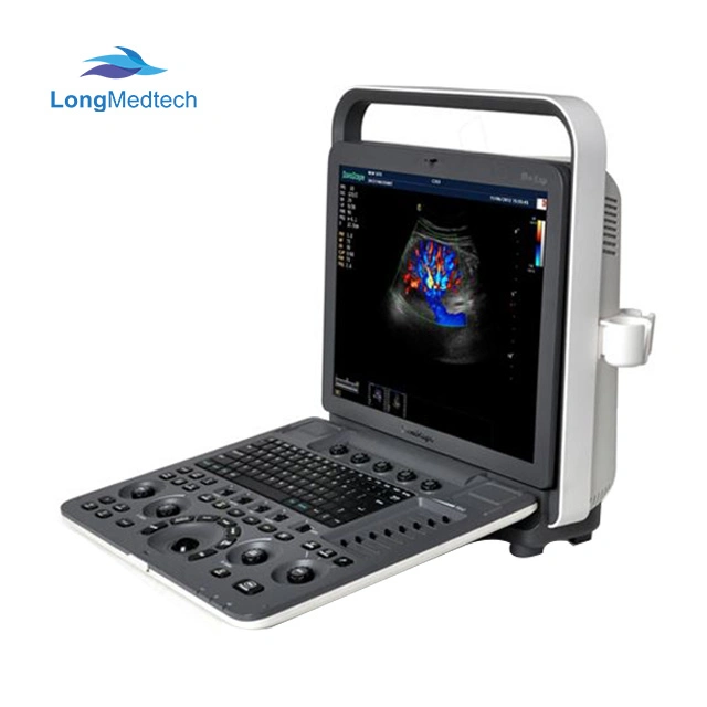 Professional 4D Color Doppler Sonoscape Ultrasound Scanner/Portable Sonoscape S8 Exp