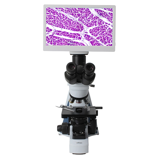 BestScope BLM2-241 microscope biologique numérique LCD 1080p 6,0MP 11.6 pouces Pour les cliniques et les laboratoires