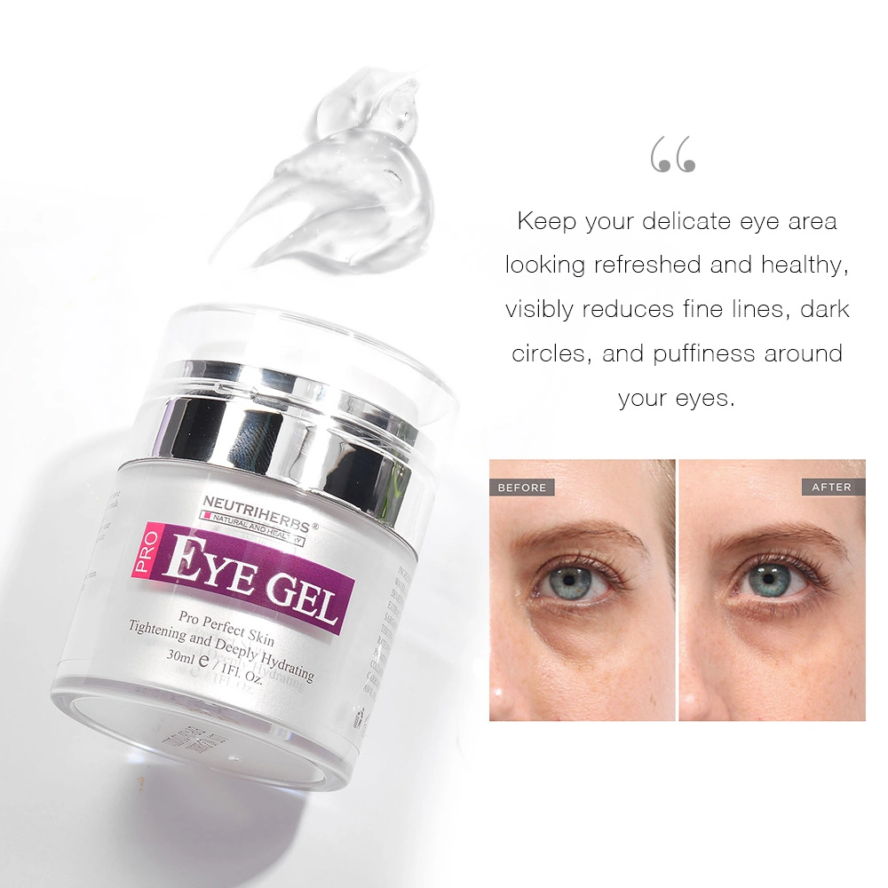 Best Selling Bio Eye Bag Removal Dark Circles Cream Natural Eye Gel