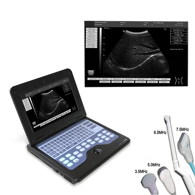 جهاز ماسح الجهاز الطبي جهاز الموجات فوق الصوتية المحمول نظام التشخيص