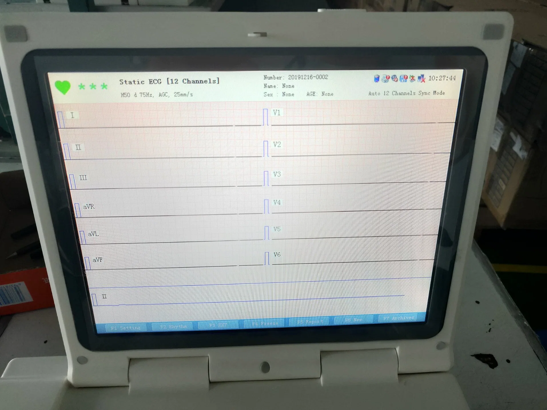 Electrocardiograma ECG-máquina Cardioología electrocardiograma para hospital,